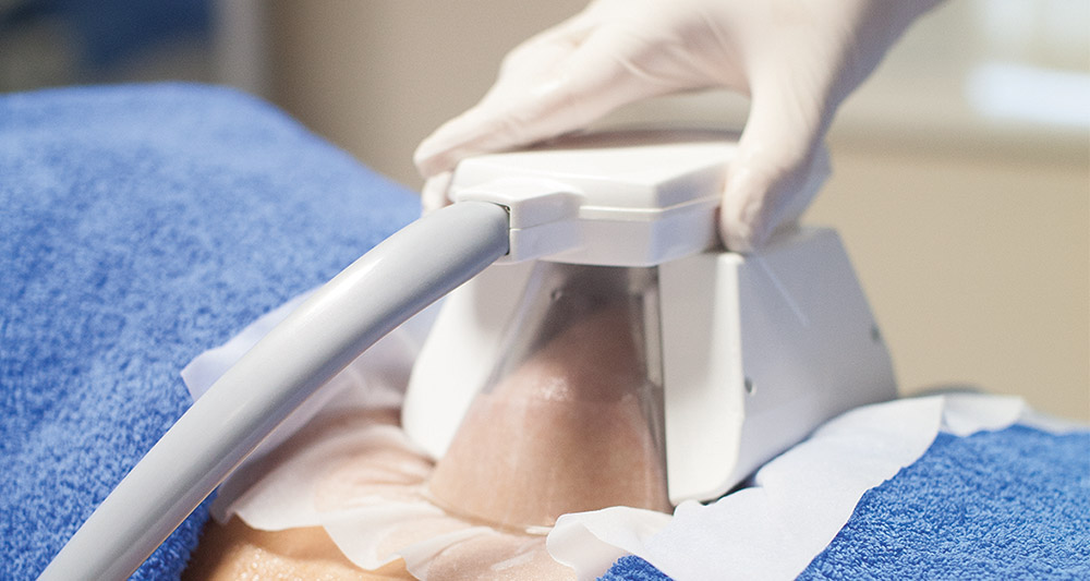 How Fat Freezing and HIFU Work Together? 2 Multiple Areas in One Session HIFU and Fat Freezing Eccles