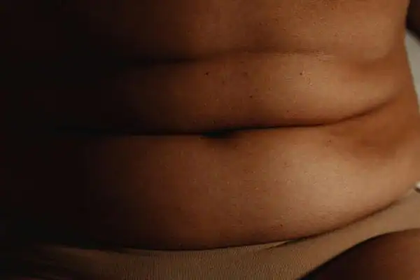 The Hidden Connection: How Stress Shapes Your Fitness and Body Composition 3 image of what stress can do on the stomach area and how Lipo 360 Eccles can help to change your body shape.